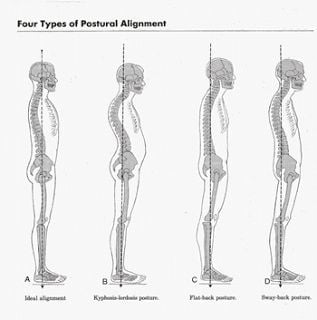 Alignment, Diagrams, and Expression